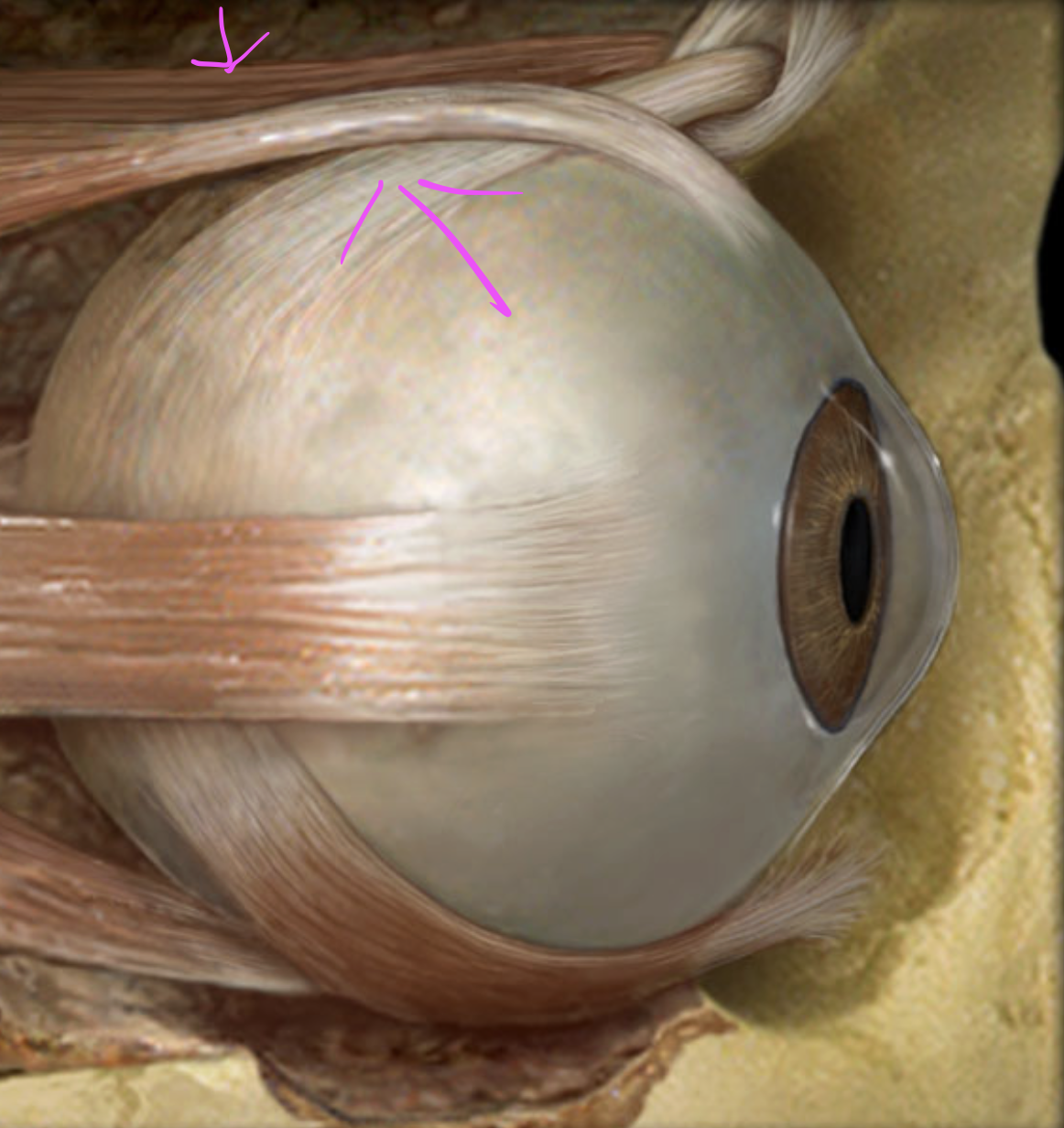 term image