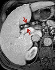 <p>What is this and what type of scan </p>