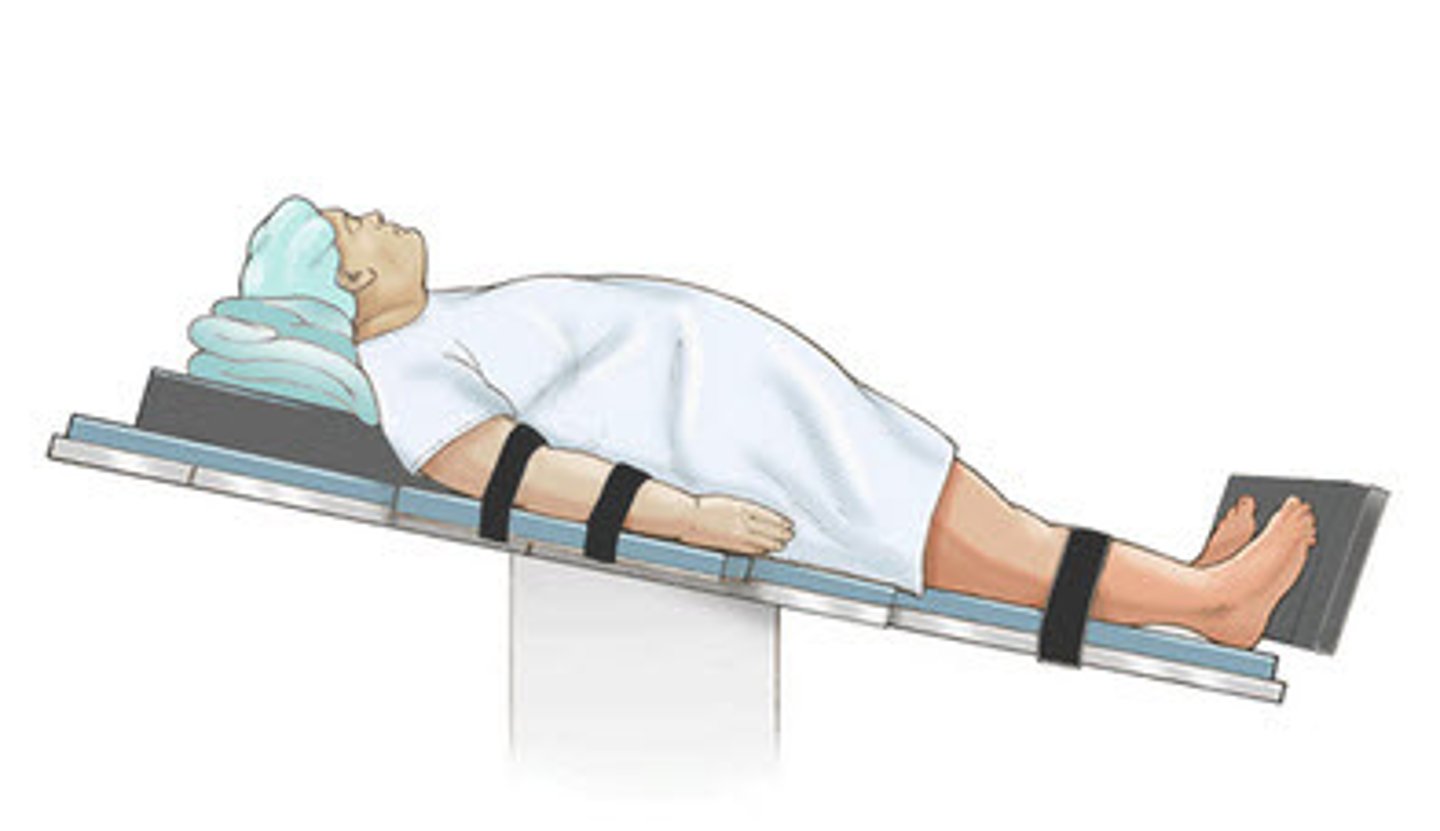 <p>reverse trendelenburg → facilitates upper abd surgery</p>