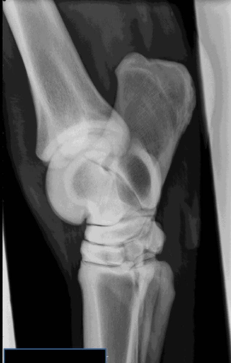 <p>Name the view and the anatomical region within the radiograph</p>