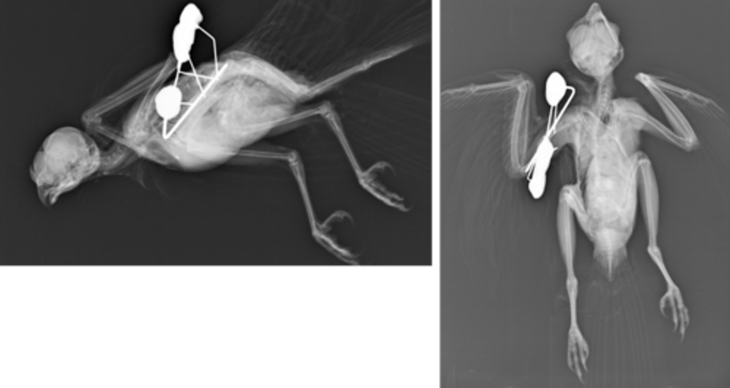 <p>-IM pin tied into uniplanar external fixator</p><p>-clamps replaced with epoxyresin to reduce weight of device</p>
