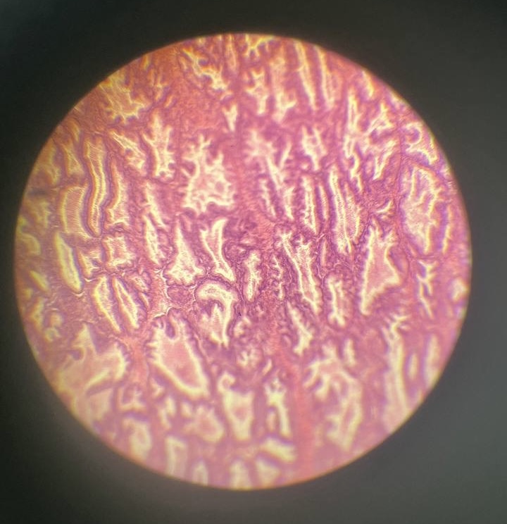 <p>Передміхурова залоза </p>