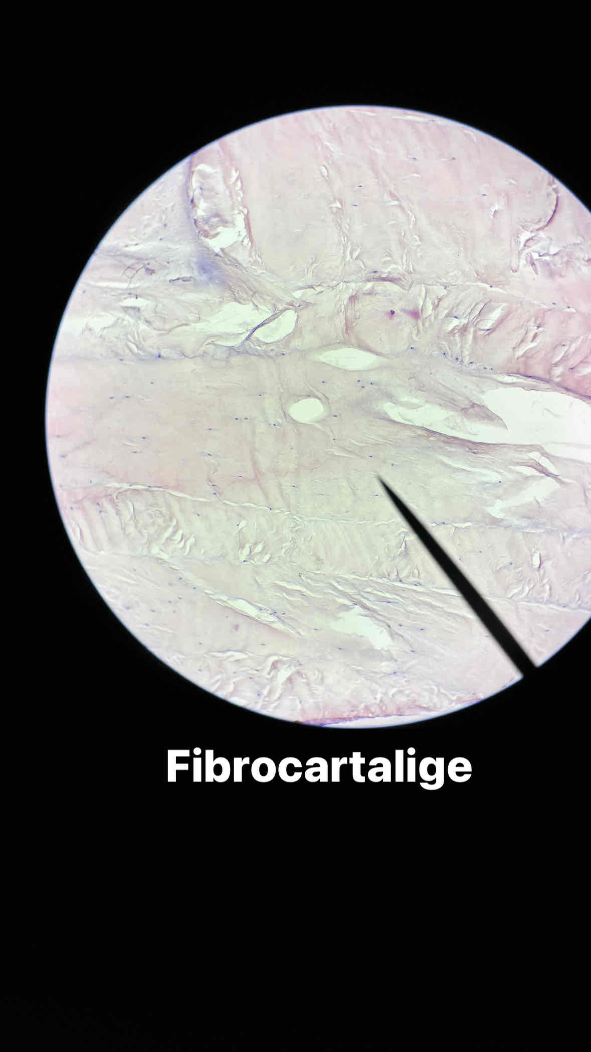 <p>type and subtype of tissue? </p>