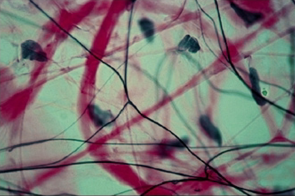 <p>What type of connective tissue is this?</p>