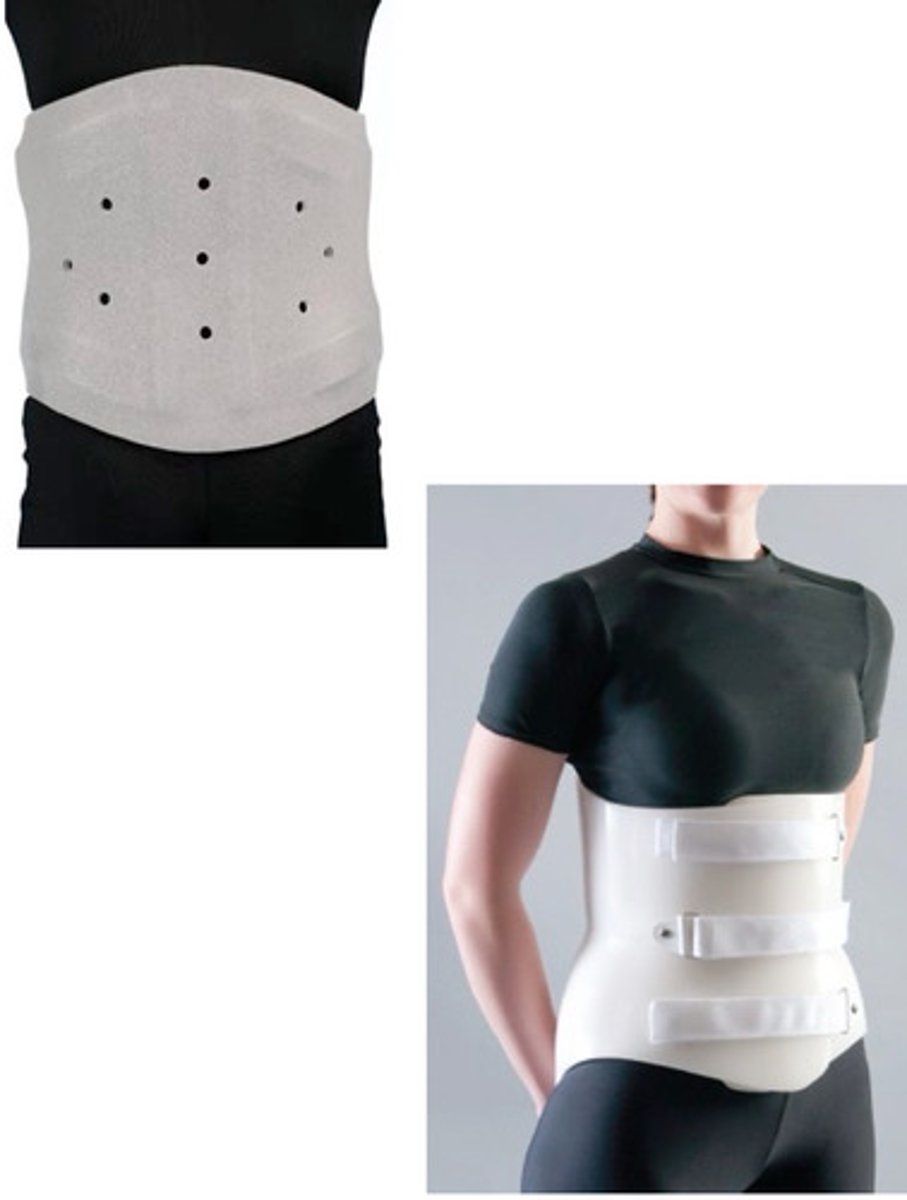 <p>anterior/superior: 12mm inferior to xiphoid process, incorporating inferior costal margin</p><p>anterior/inferior: 12mm superior to pubic symphysis, inferior to the ASIS with adequate clearance for rectus femoris</p><p>posterior/superior: 12mm inferior to inferior angle of scapula (clear scapular wing)</p><p>posterior/inferior: sacrococcygeal junction</p>