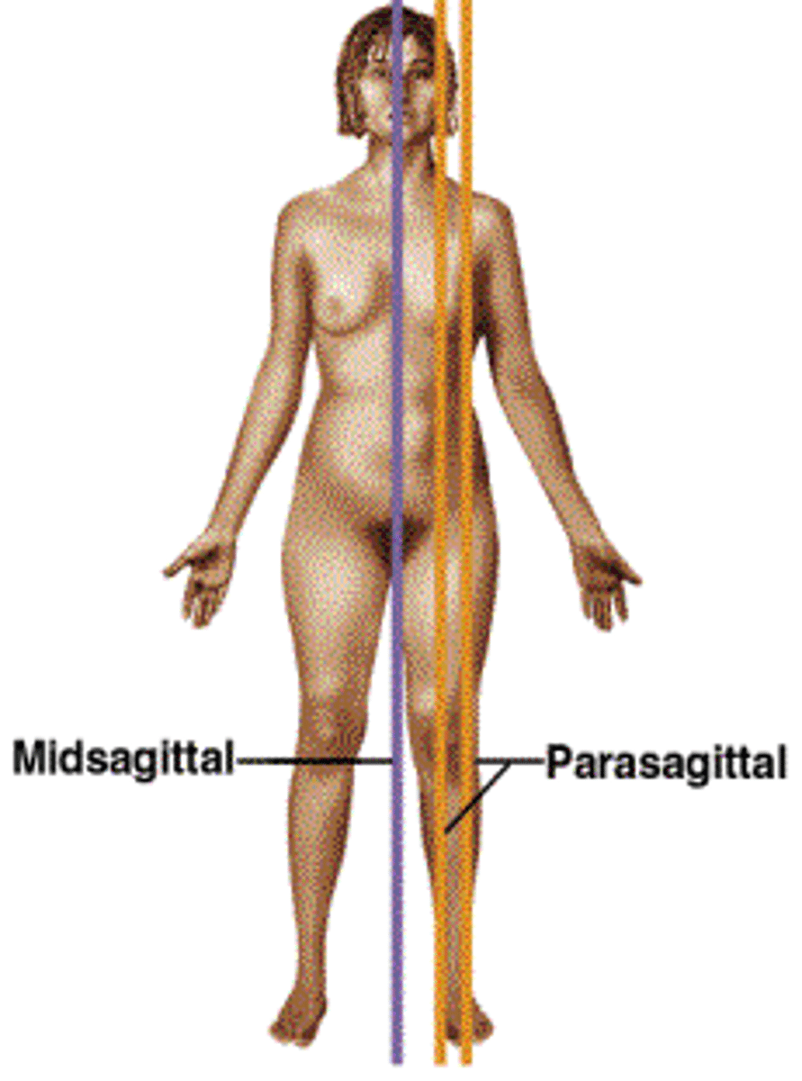 <p>Divides the body into unequal right and left sides (does not pass through the midline)</p>