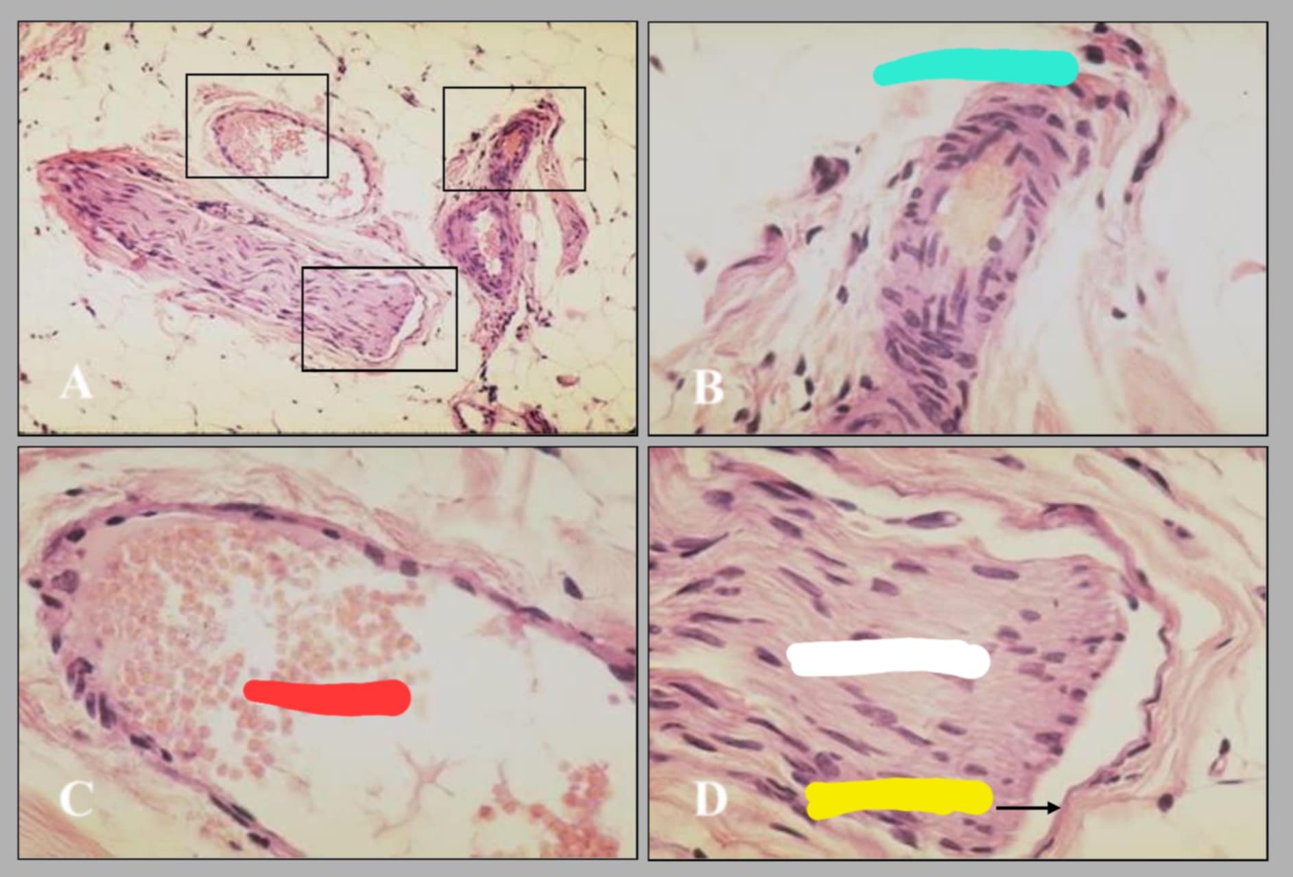 <p>name of this slide. and state its parts.</p>