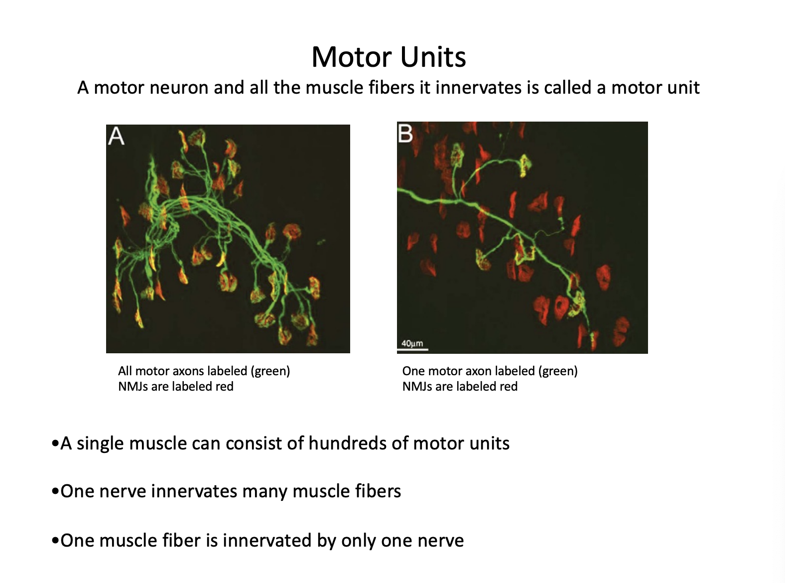 <p><span style="background-color: transparent;"><strong><span>motor unit</span></strong></span></p>