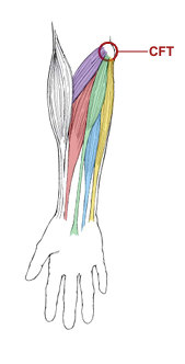 <p>What is the CFT?</p>