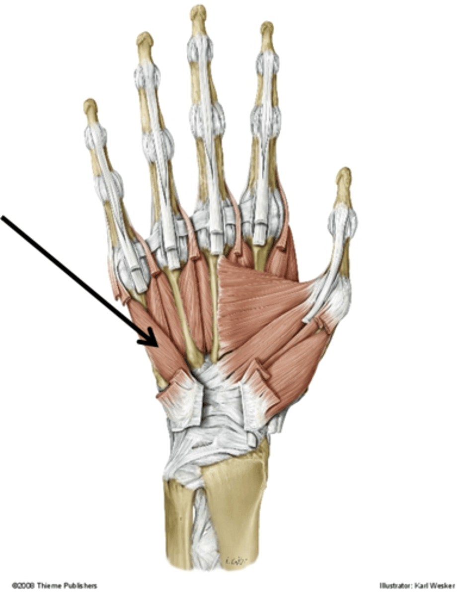 <p>Function: opposition of little finger</p><p>Innervation: ulnar nerve</p>