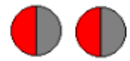 damage to the optic tract or the fiber tract from the lateral geniculate to the cortex can cause identical visual loss. In this case, loss of vision \n of the right side of the visual field