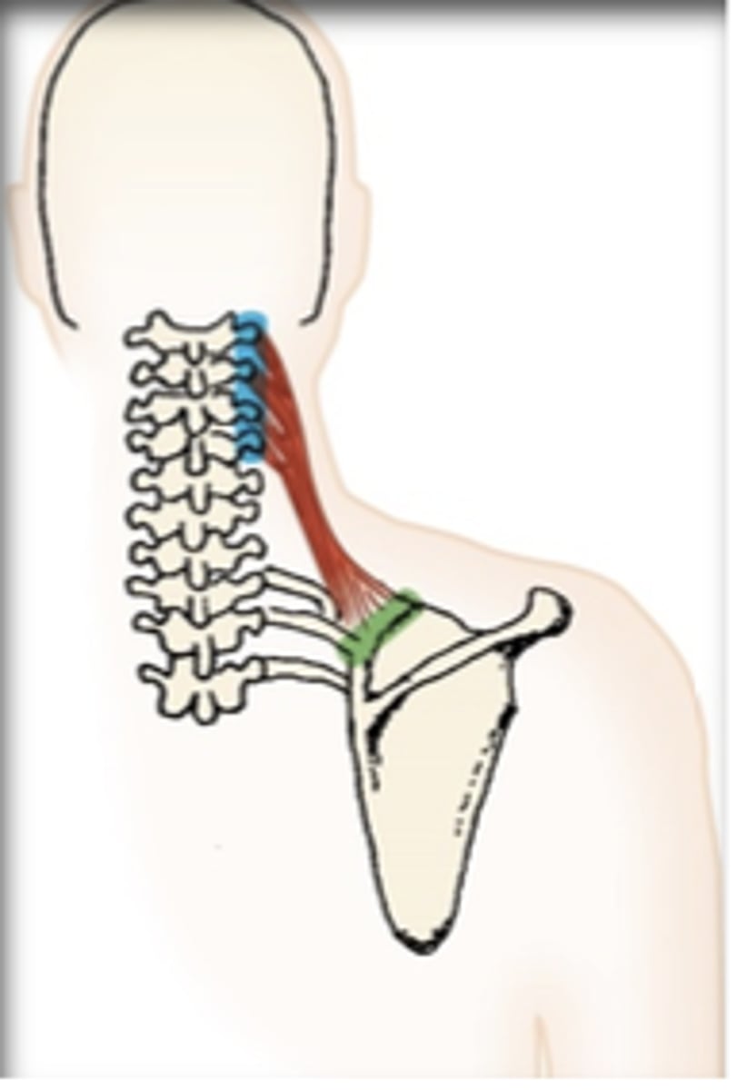 <p>What muscle is this?</p>