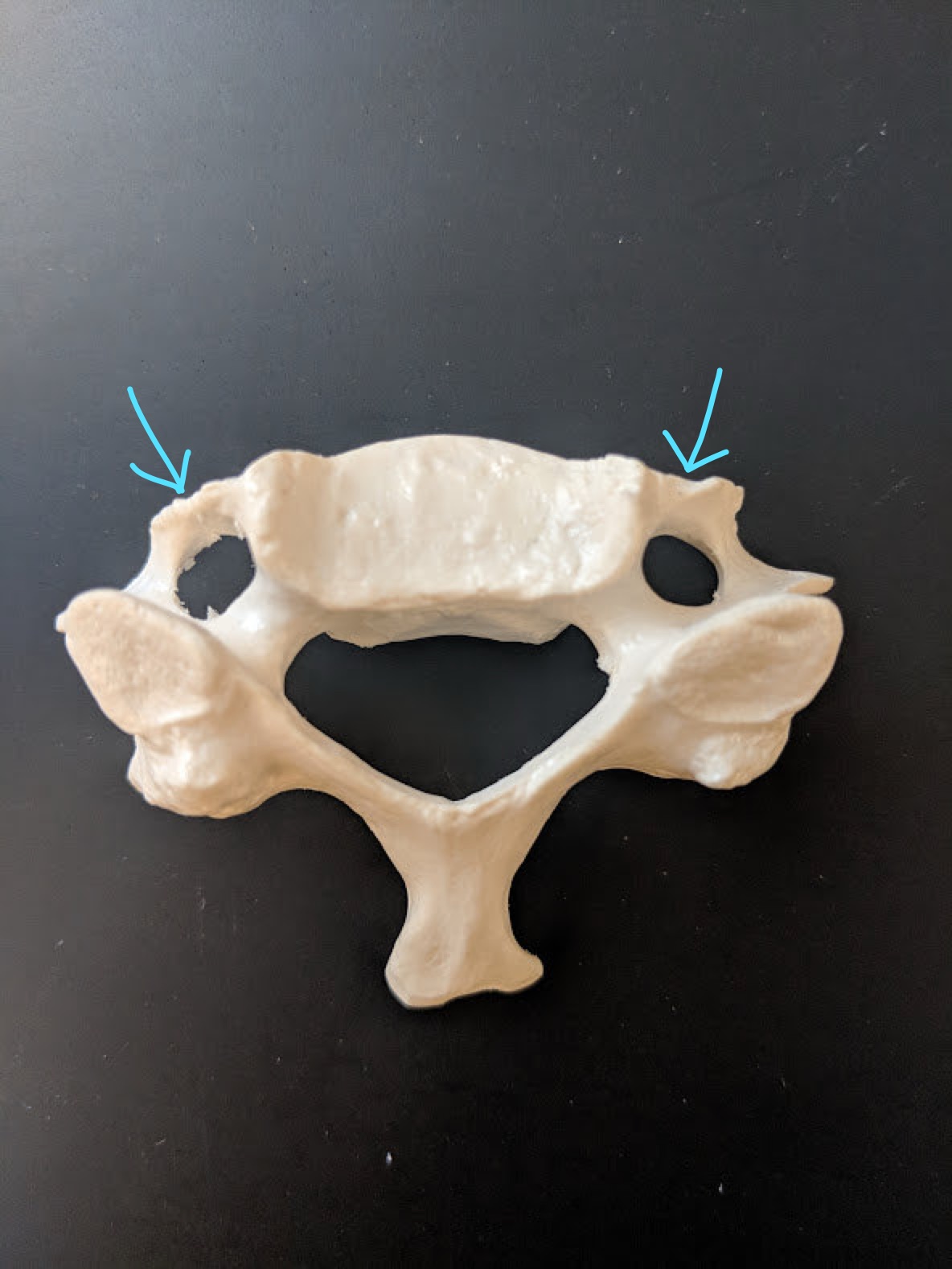 <p>Name this structure</p>