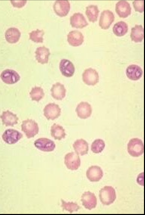 <p>What does this image show?</p>