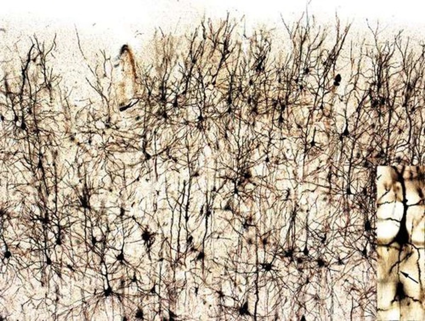 <p>Silver staining technique for neural visualization.</p>