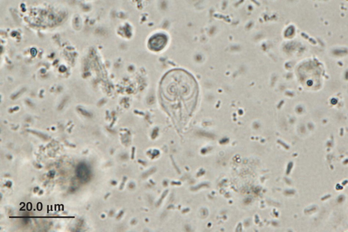 <p>What parasite is this if it is from a cat</p>