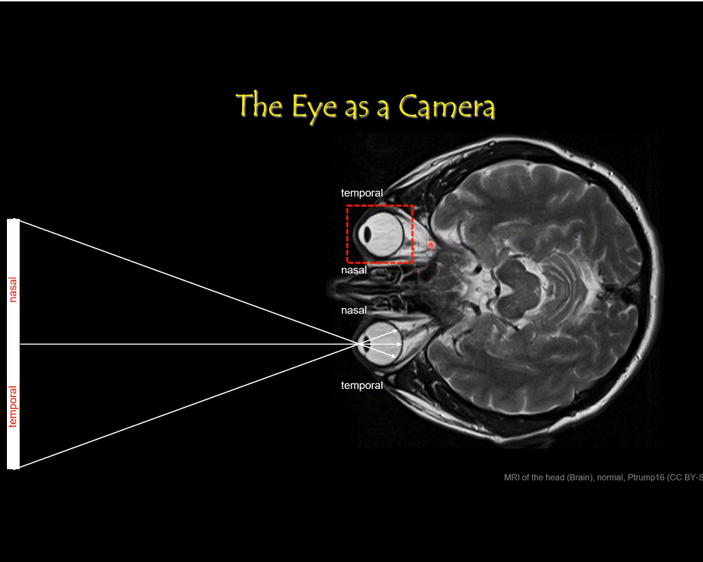 <p>Eye Structure: Stability</p>