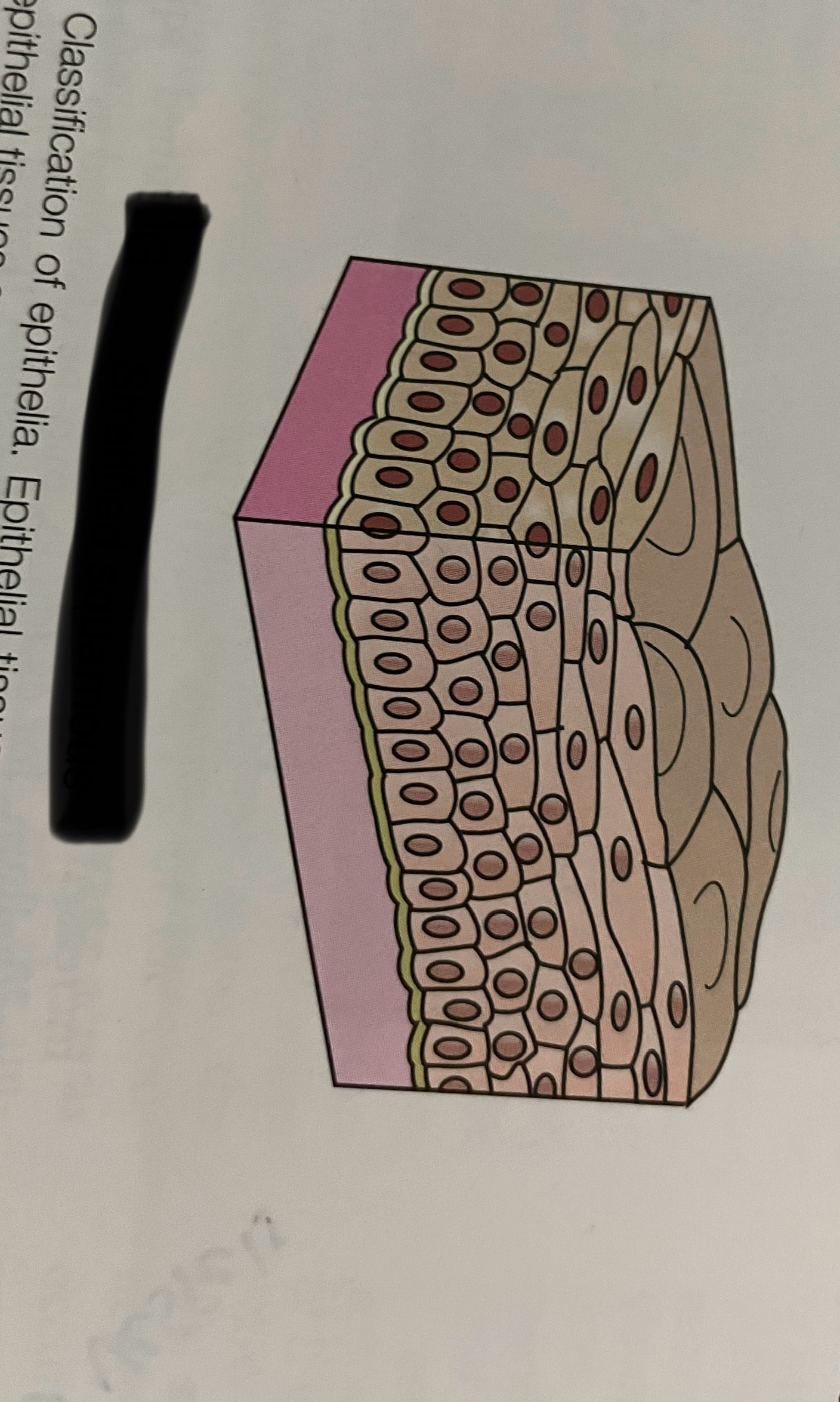 <p>what type of layering is this?</p>
