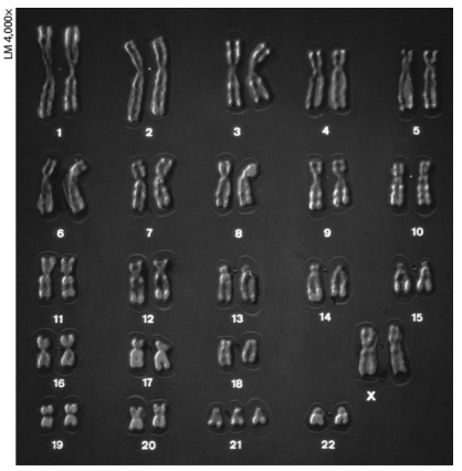 <p>which of these mistakes would be evident in the karyotype shown?</p>