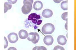 <p>what does <span style="color: rgb(255, 255, 255);"><span>Ehrlichia spp.; E. canis/E. ewingii cause </span></span></p>