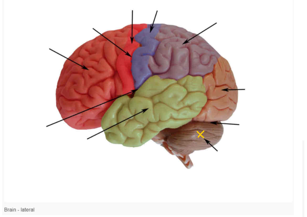 term image