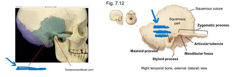 <p>What is this part of the skull?</p>