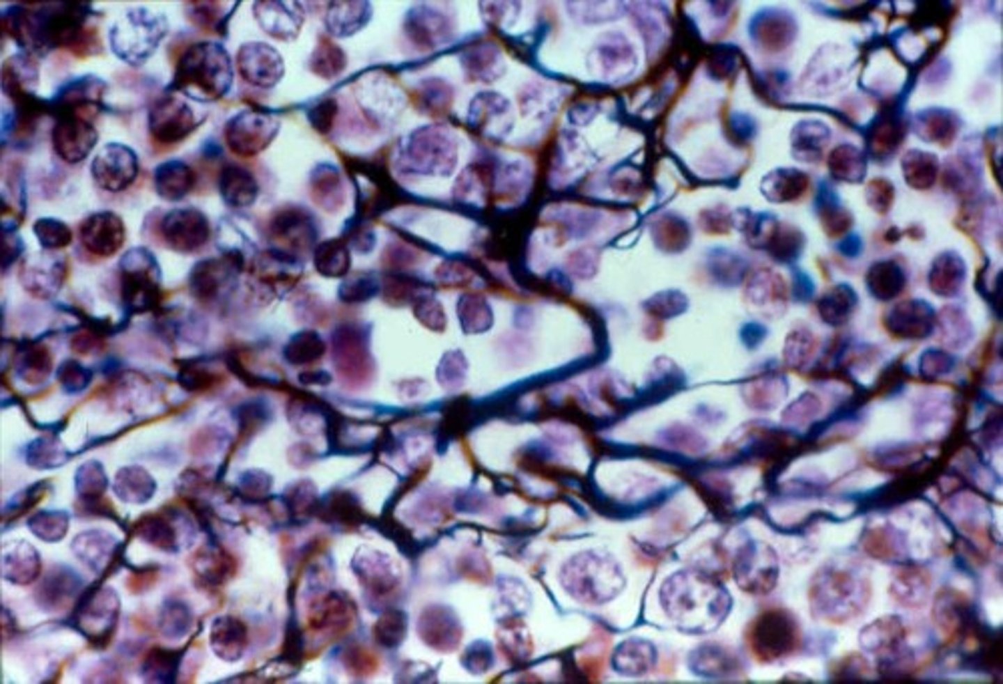 <p>- loose connective tissue</p><p>- network of reticular fibers in a typical loose ground substance; reticulocytes lie on network</p><p>- fibers form a soft internal skeleton (stroma) that supports other cell types including white blood cells, mast cells, and macrophages</p><p>- located in lymphoid organs (lymph nodes, bone marrow, spleen)</p>