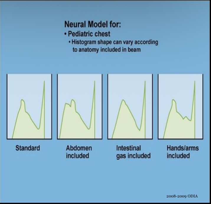 <p>Neural histogram analysis </p>