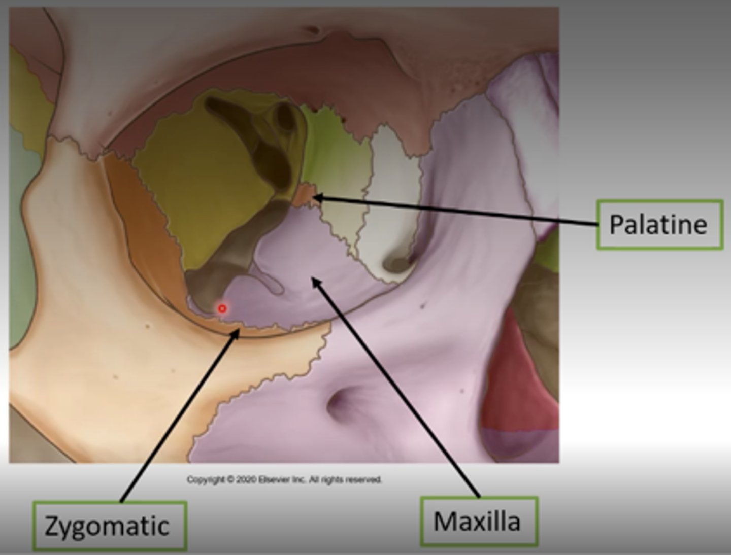 <p>Maxillary (largest), Zygomatic, Palatine.</p>