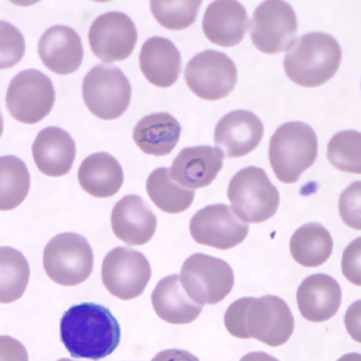 <p>infects RBCs of all ages</p><p>-ring forms can have multiple rings in same RBC</p><p>-trophozoites visible on thin smears</p>