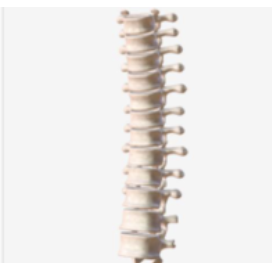 <p>Thin layers of spongy bone surrounded by compact bone and do not fit any previous bone descriptions</p>