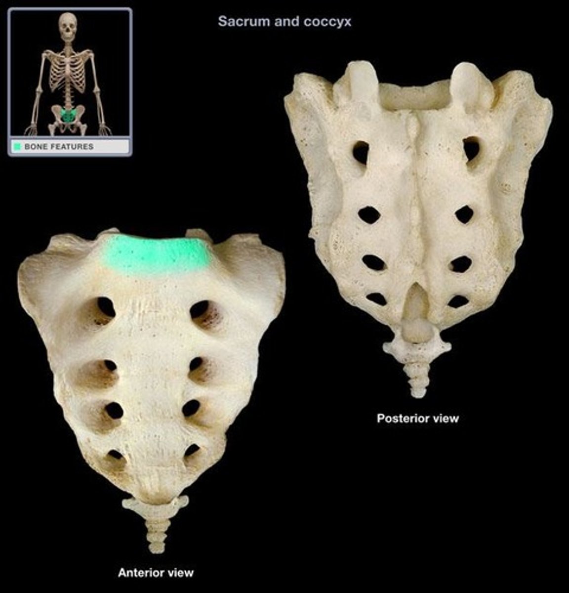 <p>Where the first sacral vertebrae bulges into pelvic cavity</p>