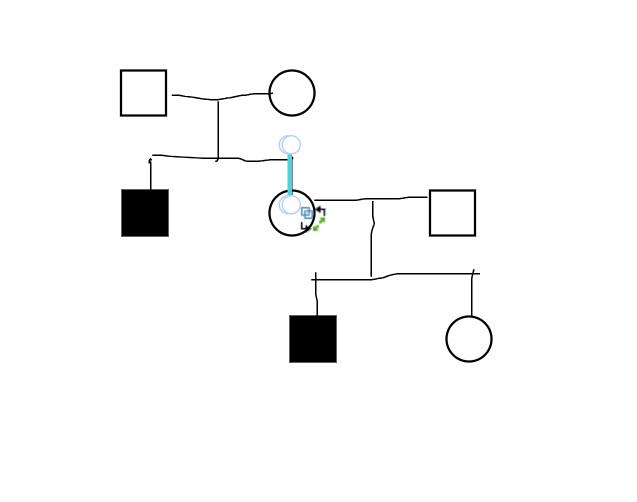 <p>Q1. what is the risk that III2 is a carrier for Duchenne muscular dystrophy (DMD) </p><p></p><p>X linked recessive </p><p>We can assume that other females are carrier </p><p>Serum creative kinase is normal (indicator of subclinical muscle damage common in DMD carriers) </p><p>2/3 carriers have abnormal results </p><p>1/3 of carriers have normal results </p><p>All healthy people have normal results </p>