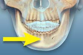 butt chin. line in the middle of the chin 