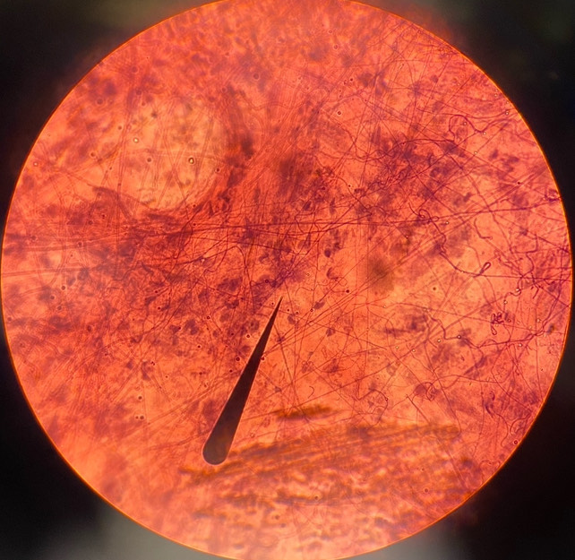 <p>example: under epithelial tissue throughout body<br>function: wraps and cushions organs</p>