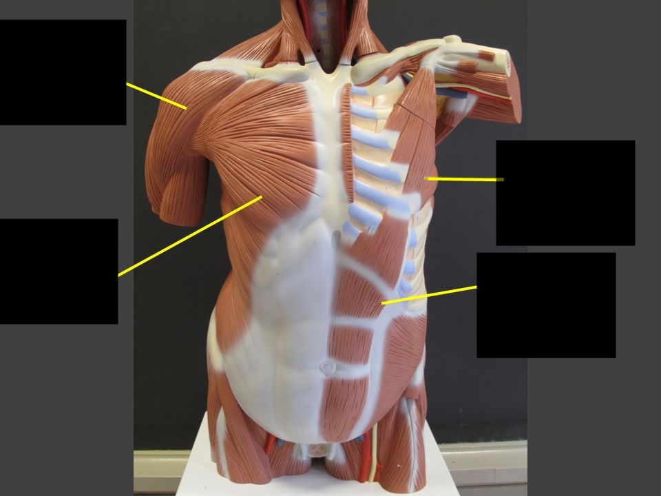 <p>What muscle is this?*****</p>