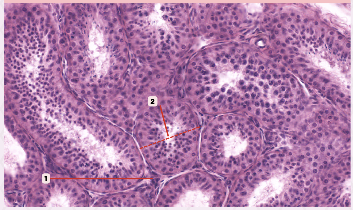 <p>Identify the structure labeled as 2.</p>