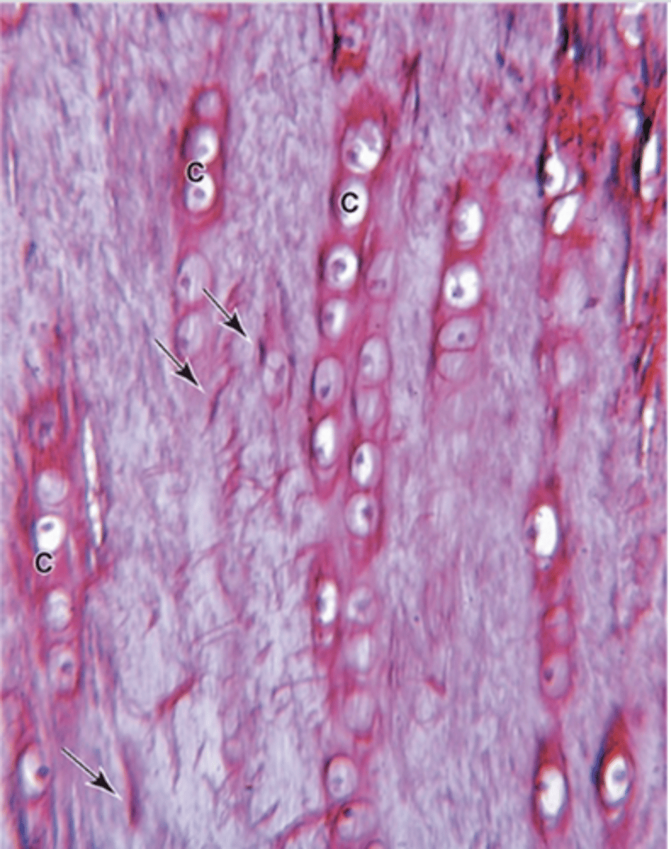 <p>What tissues is fibrocartilage a combination of? (2)</p>
