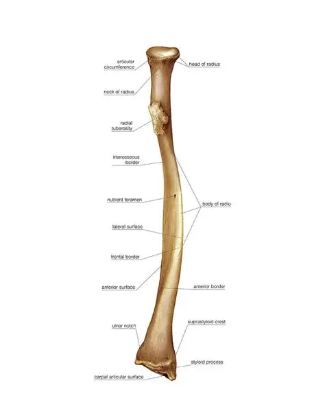 <p>Forearm bone on thumb side. Features: head (disc-shaped), radial tuberosity, styloid process.</p>