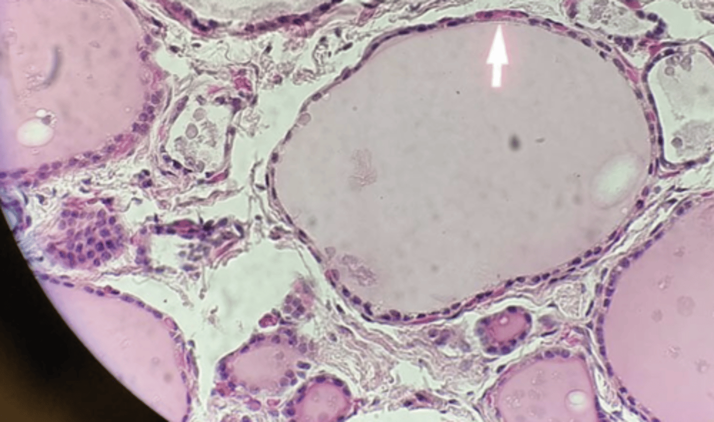 <p>What cells in the Thyroid...</p><p>&gt; Acts a a single layer of cuboidal cells surrounding the follicles</p><p>&gt; Synthesize Thyroglobulin (Convert T3 to T4) --&gt; Thyroglobin stored in LUMEN of follicles as colloid (pink, proteinaceous material)</p>