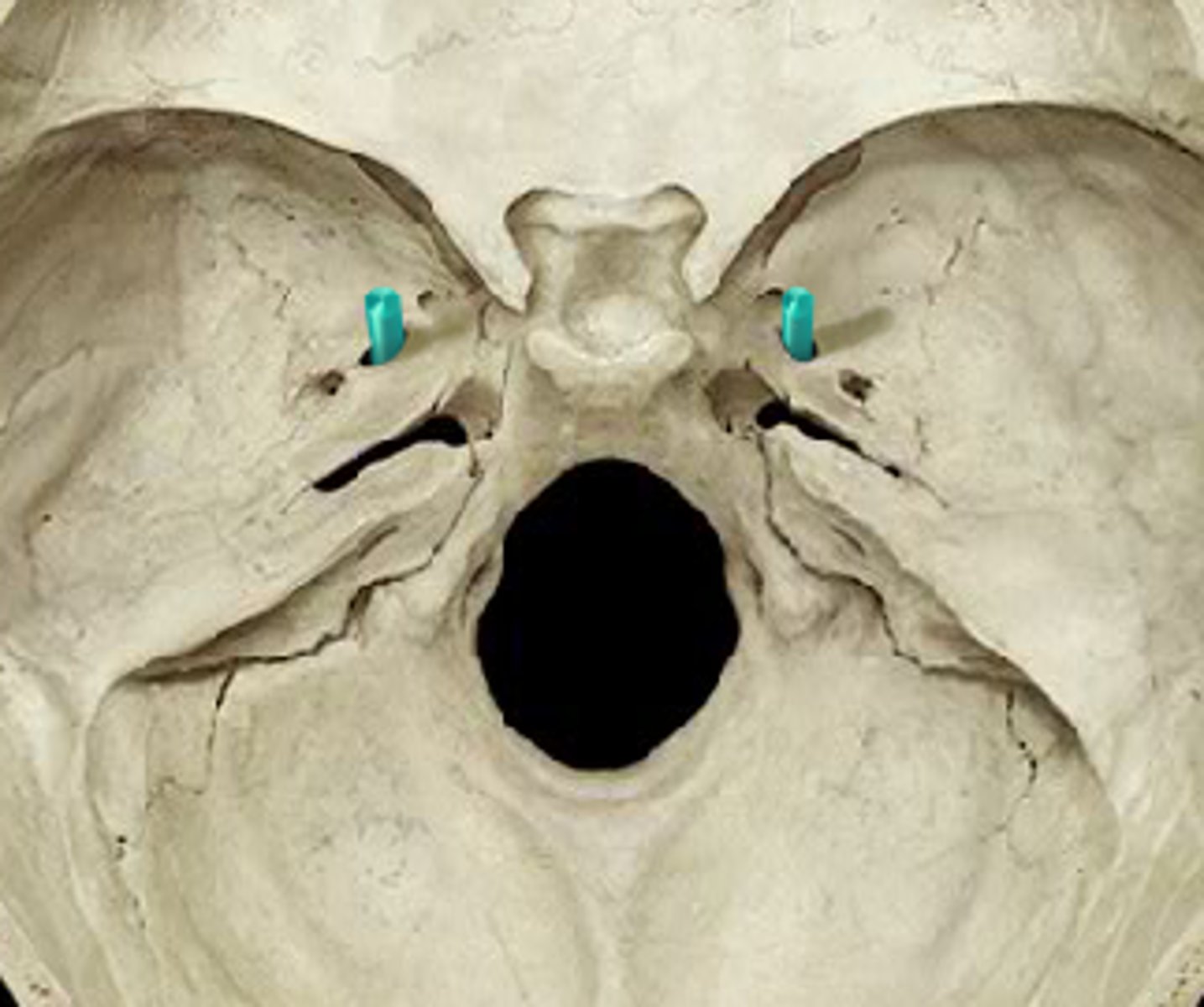 <p>mandibular branch CN V3 (of trigem)</p>