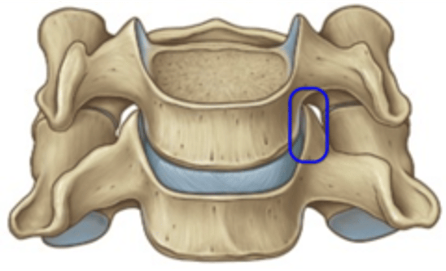 <p>uncinate processes articulate with the body of the VB above, not synovial</p><p>- limits sidebending ROM</p><p>- prevents lateral translation of IVD</p>