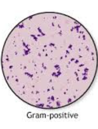 <p>Gram‑positive bacteria (purple)</p>