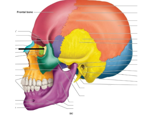 term image