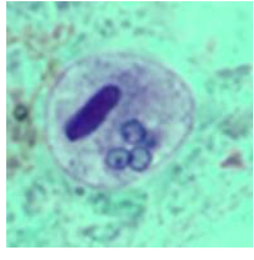<ul><li><p>trophozoite </p><ul><li><p>feeding stage </p></li><li><p>lives in host </p></li></ul></li><li><p>cyst</p><ul><li><p>exists host </p></li><li><p>resistant </p></li><li><p>transmission stage</p></li><li><p>chromatoidal bars </p><ul><li><p>deposits of nucleic acids </p></li><li><p><strong>morphology differs between spp</strong></p></li><li><p>young cysts vs. old cysts</p></li></ul></li></ul></li></ul><p></p>