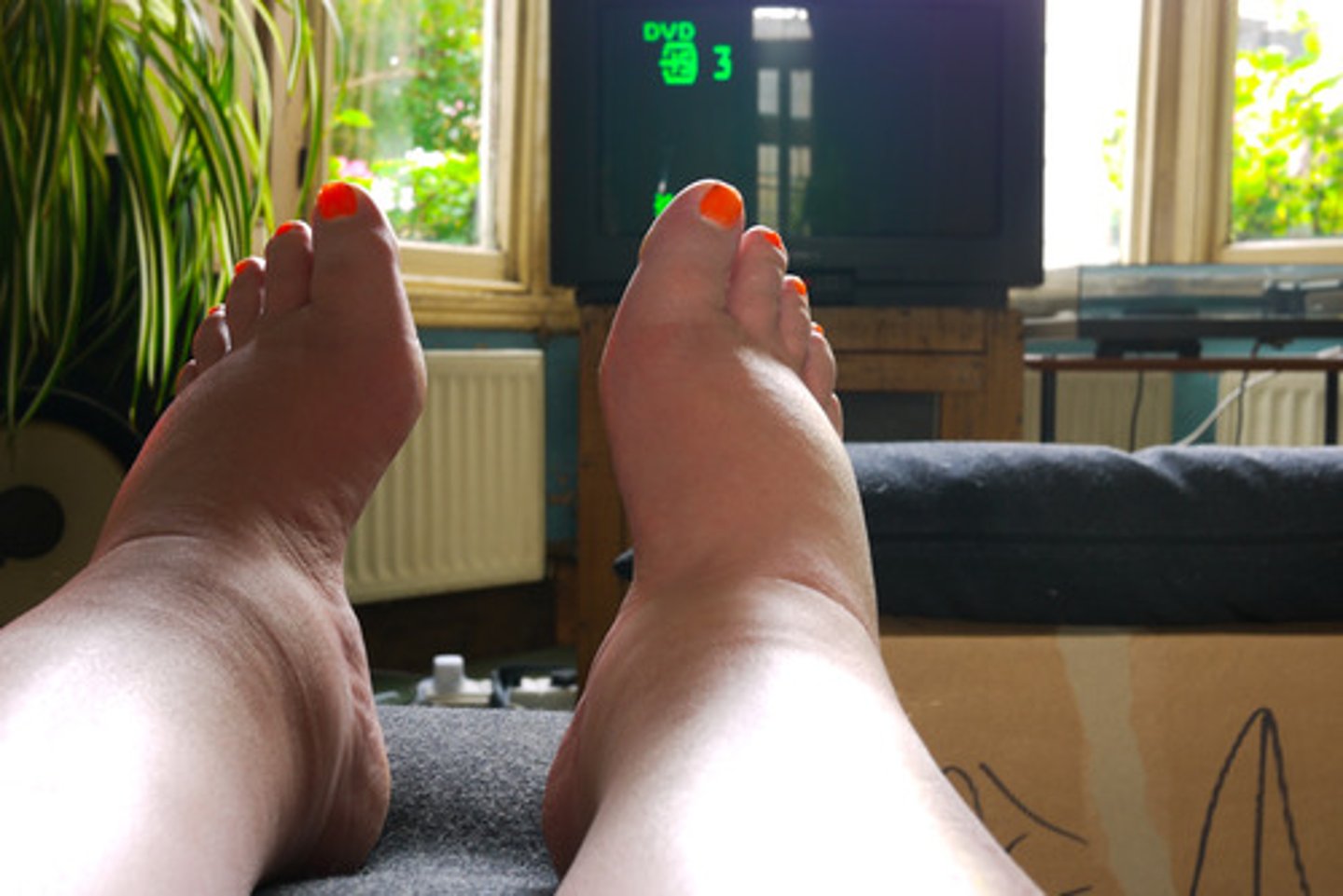 <p>The ___________ are swollen</p>