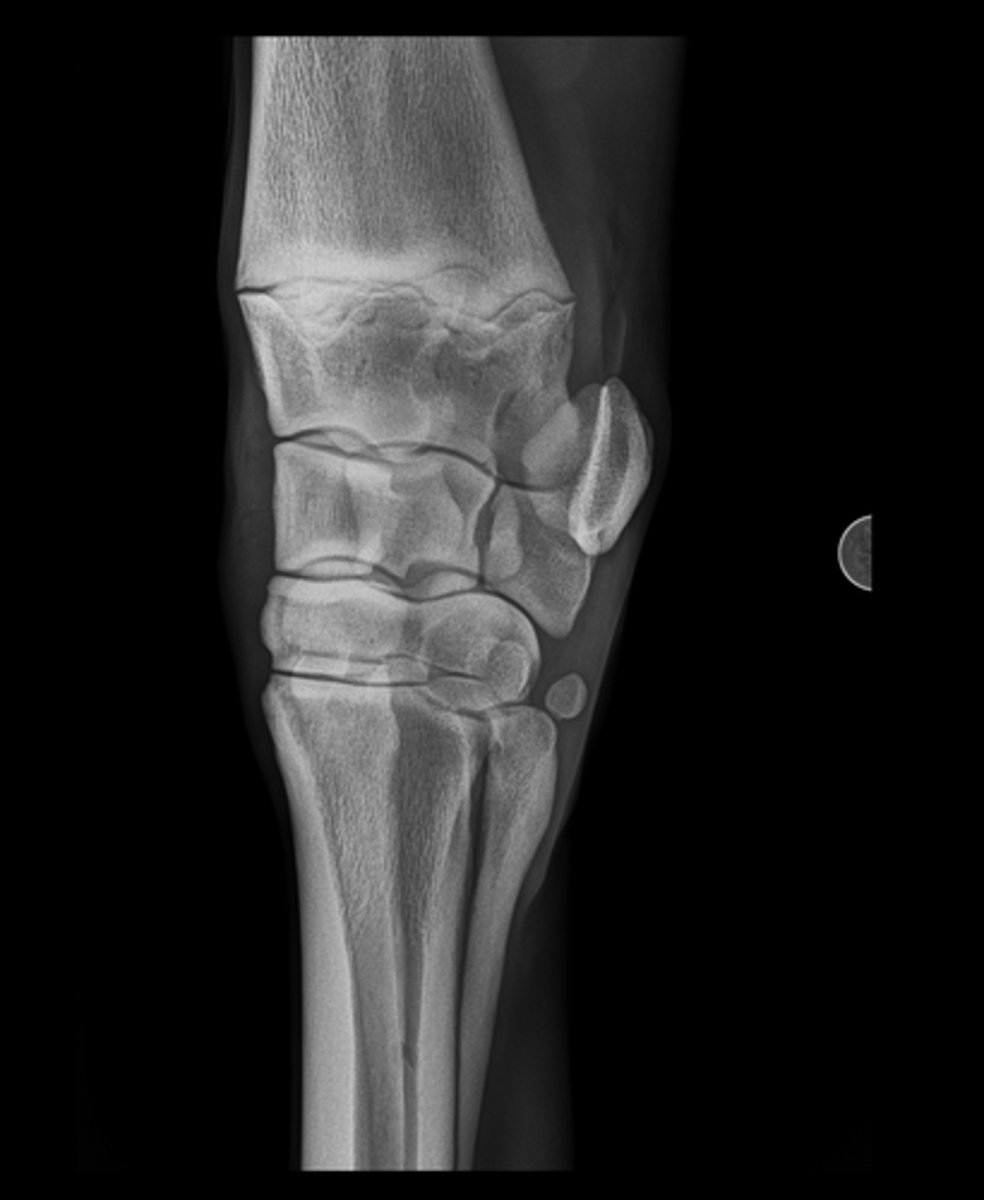<p>Name the view and the anatomical region within the radiograph</p>