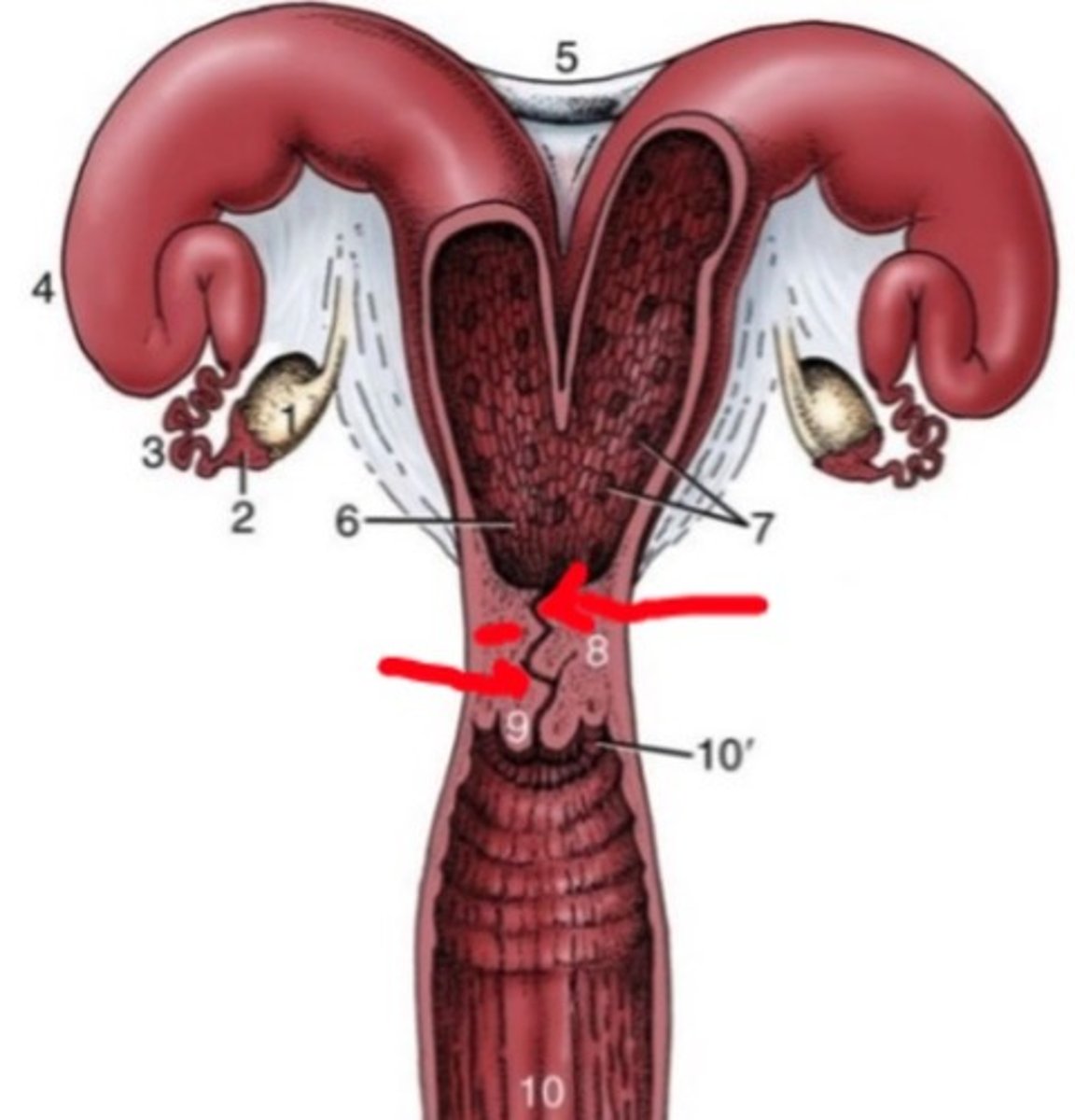 <p>Which part of the uterus is shown in the image?</p>
