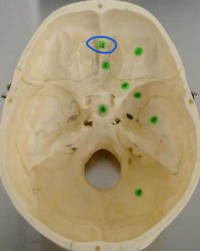 <p>#12 (internal skull) </p>