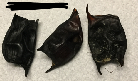 <p>What kind of egg cases are these? (Give name of the animal then the class)</p>